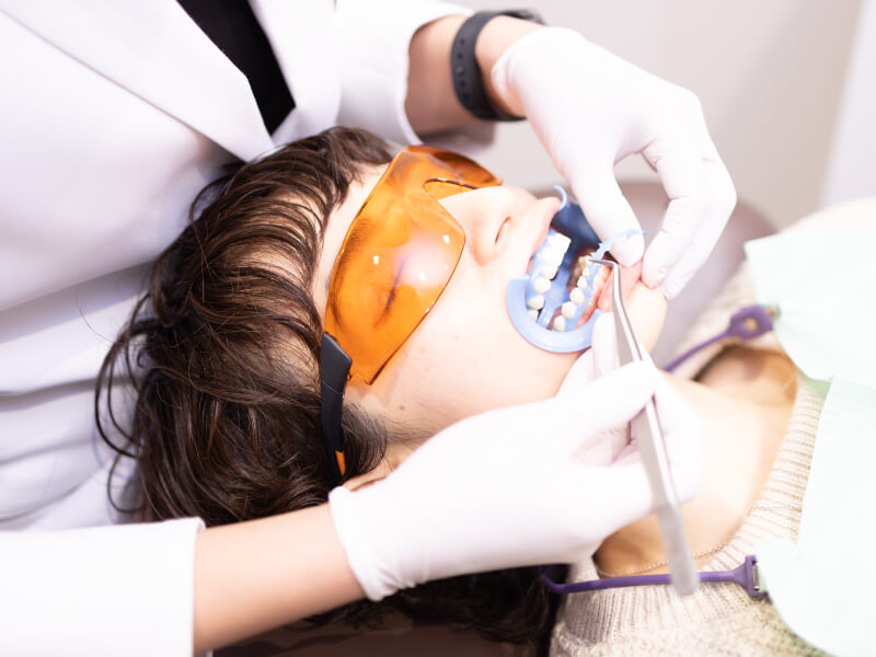 施術後の歯面清掃