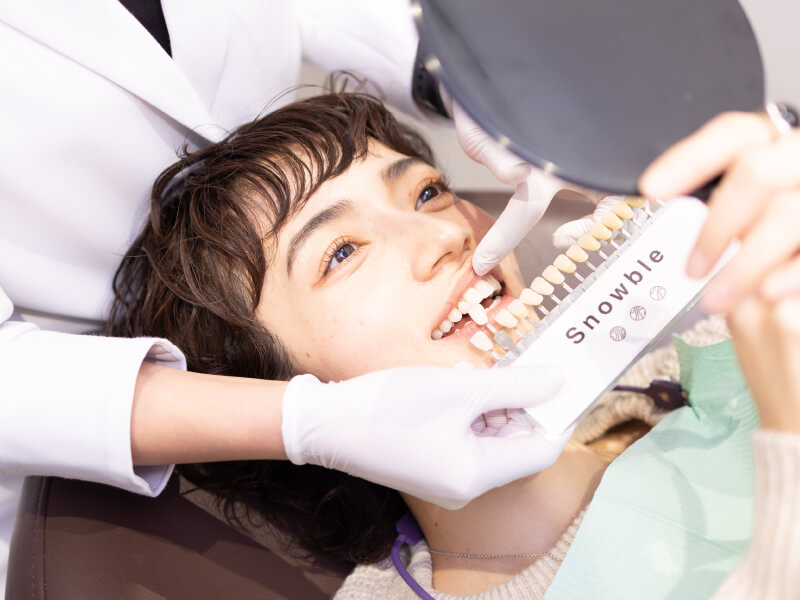 施術後の歯の色チェック