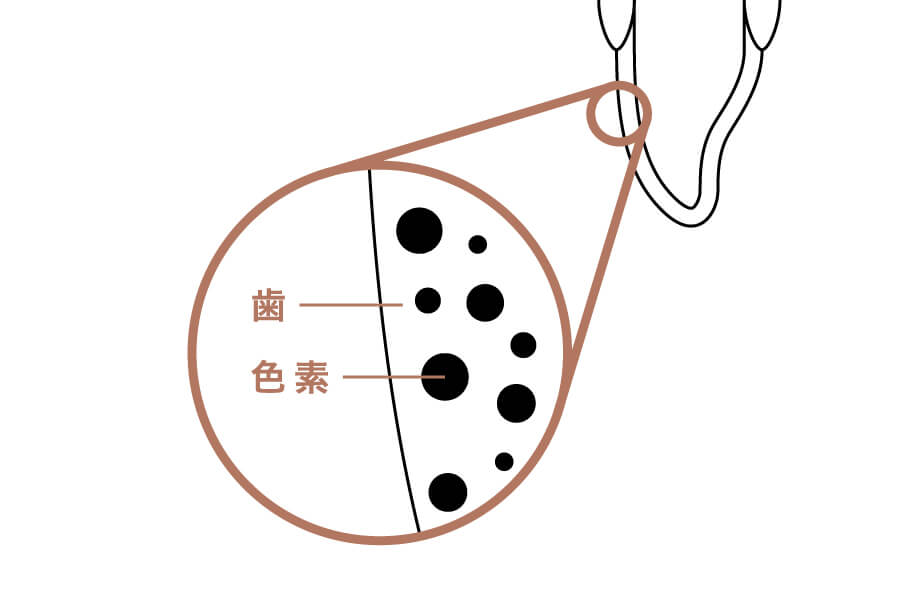 ホワイトニング前 (歯が変色した状態)