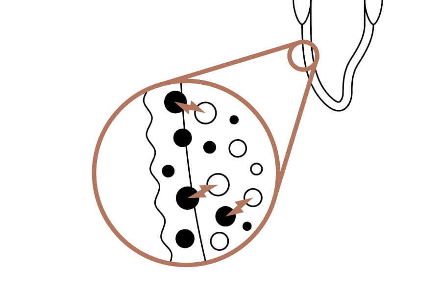 ホワイトニング中 (色素の分解)