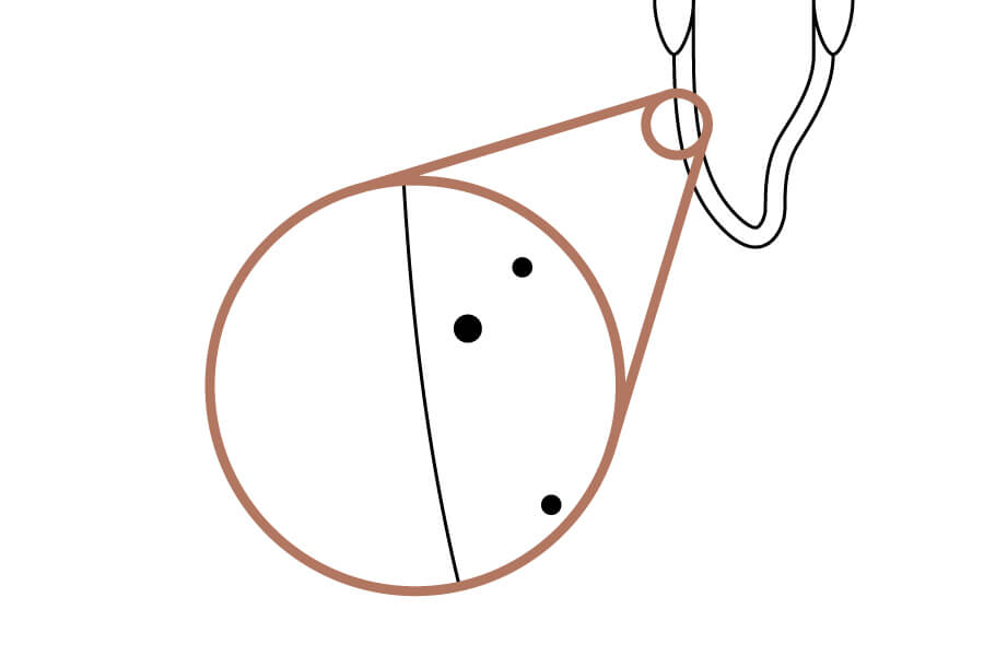 ホワイトニング後 (白くなった歯)